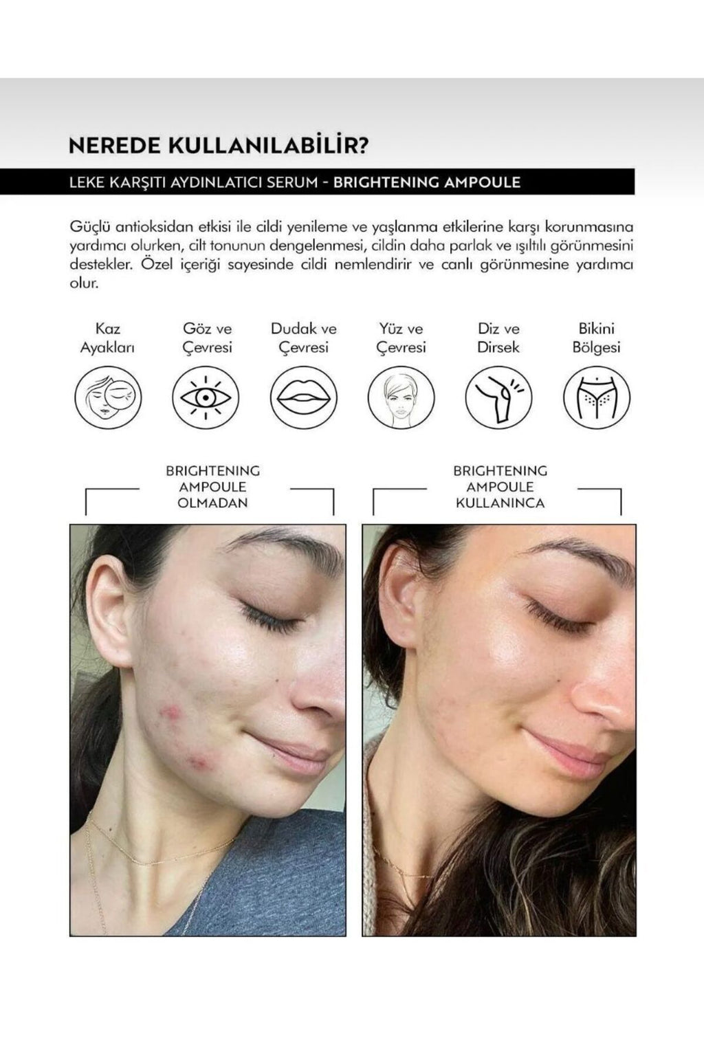 Leke Karşıtı & Cilt Tonu Eşitleyen Aydınlatıcı Ampul Serum - 30 ml | Yüz Serumu